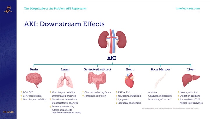 online CME poster Acute Kidney Injury: Epidemiology, Diagnosis, and Treatment