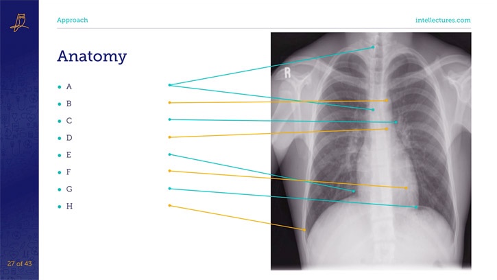 online CME poster Evaluation of Chest X-Rays: Pattern Based Techniques Using a Cased Based Approach (Part 1 of 2)