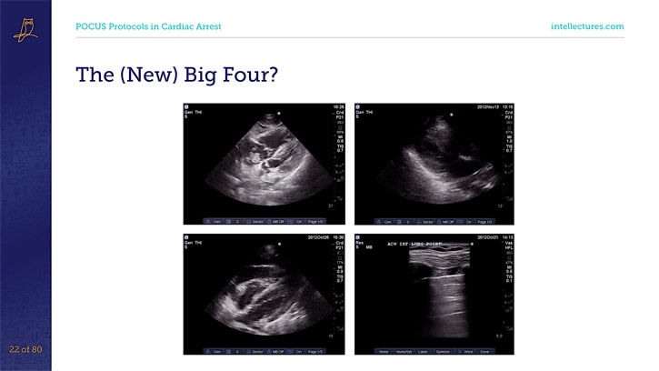 online CME poster POCUS in Cardiac Arrest: Principals & Protocols
