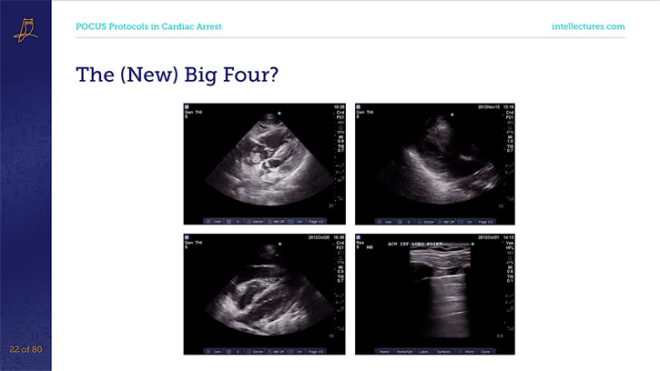 online CME poster POCUS in Cardiac Arrest: Principals & Protocols