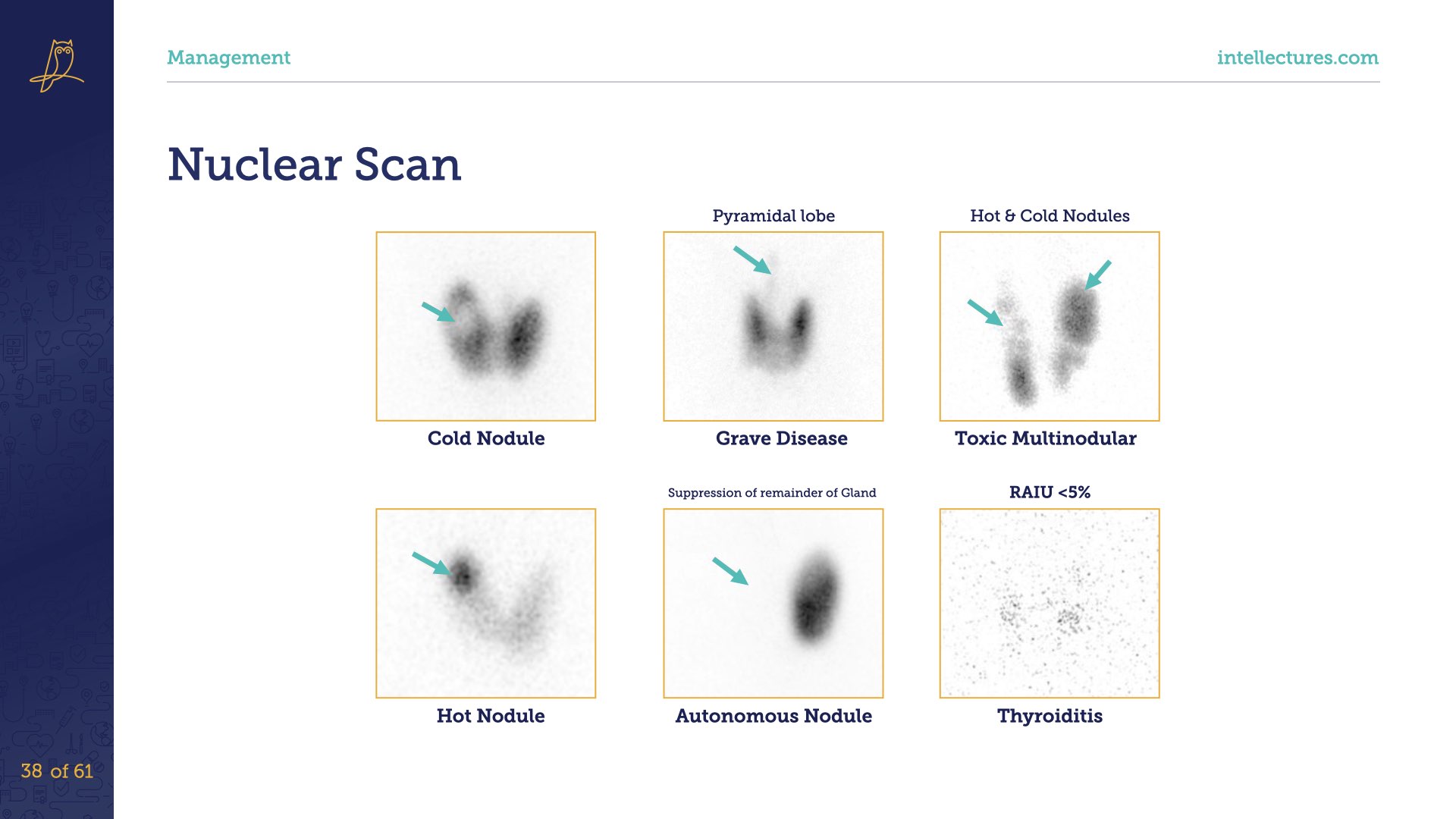 online CME poster Approach to Thyroid Nodules